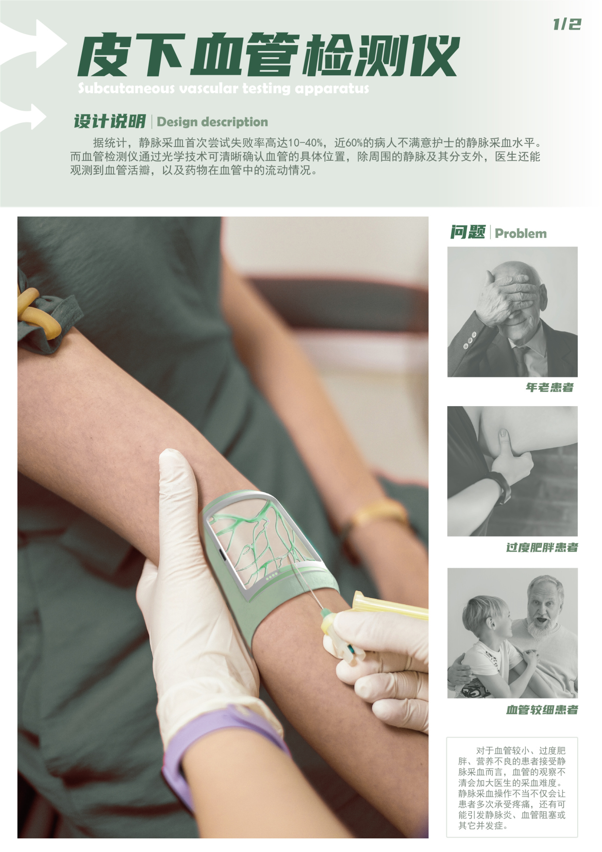 subcutaneous blood vessel detector